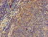 Immunohistochemistry of paraffin-embedded human lymph node tissue using CSB-PA018697LA01HU at dilution of 1:100