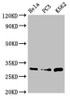 Western Blot<br />
 Positive WB detected in: Hela whole cell lysate, PC-3 whole cell lysate, K562 whole cell lysate<br />
 All lanes: PSMA1 antibody at 3.4µg/ml<br />
 Secondary<br />
 Goat polyclonal to rabbit IgG at 1/50000 dilution<br />
 Predicted band size: 30, 31 kDa<br />
 Observed band size: 30 kDa<br />