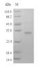 (Tris-Glycine gel) Discontinuous SDS-PAGE (reduced) with 5% enrichment gel and 15% separation gel. (Tris-Glycine gel) Discontinuous SDS-PAGE (reduced) with 5% enrichment gel and 15% separation gel.