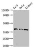 Western Blot<br />
 Positive WB detected in: Raji whole cell lysate, Hela whole cell lysate, Mouse kidney tissue<br />
 All lanes: RFC4 antibody at 2.7µg/ml<br />
 Secondary<br />
 Goat polyclonal to rabbit IgG at 1/50000 dilution<br />
 Predicted band size: 40, 34 kDa<br />
 Observed band size: 40 kDa<br />