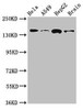 Western Blot<br />
 Positive WB detected in: Hela whole cell lysate, A549 whole cell lysate, HepG2 whole cell lysate, Mouse brain tissue<br />
 All lanes: ROCK2 antibody at 2.7µg/ml<br />
 Secondary<br />
 Goat polyclonal to rabbit IgG at 1/50000 dilution<br />
 Predicted band size: 161 kDa<br />
 Observed band size: 161 kDa<br />