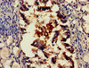 Immunohistochemistry of paraffin-embedded human lung tissue using CSB-PA020865LA01HU at dilution of 1:100