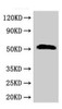 Western Blot<br />
 Positive WB detected in: Rat liver tissue<br />
 All lanes: SCTR antibody at 2.5µg/ml<br />
 Secondary<br />
 Goat polyclonal to rabbit IgG at 1/50000 dilution<br />
 Predicted band size: 51 kDa<br />
 Observed band size: 51 kDa<br />