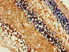 Immunohistochemistry of paraffin-embedded human eye tissue using CSB-PA021415LA01HU at dilution of 1:100