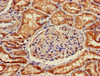 Immunohistochemistry of paraffin-embedded human kidney tissue using CSB-PA021675LA01HU at dilution of 1:100