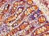 Immunohistochemistry of paraffin-embedded human small intestine tissue using CSB-PA021675LA01HU at dilution of 1:100