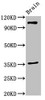 Western Blot<br />
 Positive WB detected in: Mouse brain tissue<br />
 All lanes: SLITRK5 antibody at 2µg/ml<br />
 Secondary<br />
 Goat polyclonal to rabbit IgG at 1/50000 dilution<br />
 Predicted band size: 108, 80 kDa<br />
 Observed band size: 108 kDa<br />