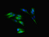 Immunofluorescent analysis of Hela cells using CSB-PA021774LA01HU at dilution of 1:100 and Alexa Fluor 488-congugated AffiniPure Goat Anti-Rabbit IgG (H+L)