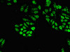 Immunofluorescent analysis of Hela cells using CSB-PA022813EA01HU at dilution of 1:100 and Alexa Fluor 488-congugated AffiniPure Goat Anti-Rabbit IgG (H+L)