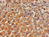 Immunohistochemistry of paraffin-embedded human adrenal gland tissue using CSB-PA022907LA01HU at dilution of 1:100