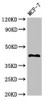 Western Blot<br />
 Positive WB detected in: MCF-7 whole cell lysate<br />
 All lanes: TMEM173 antibody at 2.7µg/ml<br />
 Secondary<br />
 Goat polyclonal to rabbit IgG at 1/50000 dilution<br />
 Predicted band size: 43 kDa<br />
 Observed band size: 43 kDa<br />