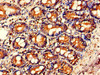 Immunohistochemistry of paraffin-embedded human small intestine tissue using CSB-PA06719A0Rb at dilution of 1:100 Immunohistochemistry of paraffin-embedded human small intestine tissue using CSB-PA06719A0Rb at dilution of 1:100