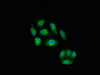 Immunofluorescent analysis of HepG2 cells using CSB-PA06719A0Rb at dilution of 1:100 and Alexa Fluor 488-congugated AffiniPure Goat Anti-Rabbit IgG (H+L) Immunofluorescent analysis of HepG2 cells using CSB-PA06719A0Rb at dilution of 1:100 and Alexa Fluor 488-congugated AffiniPure Goat Anti-Rabbit IgG (H+L)