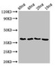 Western Blot<br />
 Positive WB detected in Recombinant protein<br />
 All lanes: ftsZ antibody at 3.5µg/ml<br />
 Secondary<br />
 Goat polyclonal to rabbit IgG at 1/50000 dilution<br />
 predicted band size: 39 kDa<br />
 observed band size: 39 kDa<br />