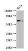 Western Blot<br />
 Positive WB detected in: Hela whole cell lysate<br />
 All lanes: TRIP4 antibody at 4µg/ml<br />
 Secondary<br />
 Goat polyclonal to rabbit IgG at 1/50000 dilution<br />
 Predicted band size: 67 kDa<br />
 Observed band size: 67 kDa<br />