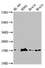 Western Blot<br />
 Positive WB detected in: HL60 whole cell lysate, K562 whole cell lyaste, Mouse brain tissue, Rat brain tissue<br />
 All lanes: UBE2V2 antibody at 1.5µg/ml<br />
 Secondary<br />
 Goat polyclonal to rabbit IgG at 1/50000 dilution<br />
 Predicted band size: 17 kDa<br />
 Observed band size: 17 kDa<br />