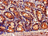 Immunohistochemistry of paraffin-embedded human small intestine tissue using CSB-PA622686LA01HU at dilution of 1:100