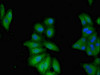 Immunofluorescent analysis of Hela cells using CSB-PA622686LA01HU at dilution of 1:100 and Alexa Fluor 488-congugated AffiniPure Goat Anti-Rabbit IgG (H+L)