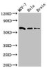 Western Blot<br />
 Positive WB detected in: MCF-7 whole cell lysate, Hela whole cell lysate, Mouse brain tissue<br />
 All lanes: SGO1 antibody at 3µg/ml<br />
 Secondary<br />
 Goat polyclonal to rabbit IgG at 1/50000 dilution<br />
 Predicted band size: 65, 36, 34, 32, 30, 61, 25 kDa<br />
 Observed band size: 65 kDa<br />