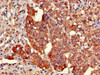 Immunohistochemistry of paraffin-embedded human adrenal gland tissue using CSB-PA705509LA01HU at dilution of 1:100