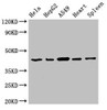 Western Blot<br />
 Positive WB detected in: Hela whole cell lysate, HepG2 whole cell lysate, A549 whole cell lysate, Rat heart tissue, Rat spleen tissue<br />
 All lanes: EIF3M antibody at 2.7µg/ml<br />
 Secondary<br />
 Goat polyclonal to rabbit IgG at 1/50000 dilution<br />
 Predicted band size: 43, 28 kDa<br />
 Observed band size: 43 kDa<br />