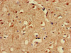 Immunohistochemistry of paraffin-embedded human brain tissue using CSB-PA773600LA01HU at dilution of 1:100