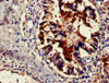 Immunohistochemistry of paraffin-embedded human lung tissue using CSB-PA836166HA01HU at dilution of 1:100