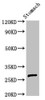 Western Blot<br />
 Positive WB detected in: Rat stomach tissue<br />
 All lanes: AKT1S1 antibody at 3µg/ml<br />
 Secondary<br />
 Goat polyclonal to rabbit IgG at 1/50000 dilution<br />
 Predicted band size: 28, 14, 30 kDa<br />
 Observed band size: 28 kDa<br />
