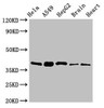 Western Blot<br />
 Positive WB detected in: Hela whole cell lysate, A549 whole cell lysate, HepG2 whole cell lysate, Mouse brain tissue, Rat heart tissue<br />
 All lanes: RBFA antibody at 2µg/ml<br />
 Secondary<br />
 Goat polyclonal to rabbit IgG at 1/50000 dilution<br />
 Predicted band size: 39, 28 kDa<br />
 Observed band size: 39 kDa<br />