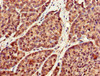 Immunohistochemistry of paraffin-embedded human ovarian cancer using CSB-PA836636LA01HU at dilution of 1:100