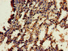 Immunohistochemistry of paraffin-embedded human lung tissue using CSB-PA836636LA01HU at dilution of 1:100