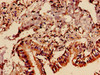 Immunocytochemistry analysis of human lung tissue using CSB-PA848403LA01HU at dilution of 1:100