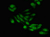 Immunofluorescent analysis of Hela cells using CSB-PA867110LA01HU at dilution of 1:100 and Alexa Fluor 488-congugated AffiniPure Goat Anti-Rabbit IgG (H+L)