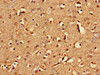 Immunohistochemistry of paraffin-embedded human brain tissue using CSB-PA872478LA01HU at dilution of 1:100
