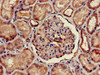 Immunohistochemistry of paraffin-embedded human kidney tissue using CSB-PA874860LA01HU at dilution of 1:100 Immunohistochemistry of paraffin-embedded human kidney tissue using CSB-PA874860LA01HU at dilution of 1:100