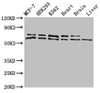 Western Blot<br />
 Positive WB detected in: MCF-7 whole cell lysate, HEK293 whole cell lysate, K562 whole cell lysate, Mouse heart tissue, Mouse brain tissue, Mouse liver tissue<br />
 All lanes: ACAD9 antibody at 1µg/ml<br />
 Secondary<br />
 Goat polyclonal to rabbit IgG at 1/50000 dilution<br />
 Predicted band size: 69 kDa<br />
 Observed band size: 69, 70 kDa<br />