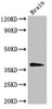 Western Blot<br />
 Positive WB detected in: Mouse brain tissue<br />
 All lanes: B4GALT7 antibody at 3µg/ml<br />
 Secondary<br />
 Goat polyclonal to rabbit IgG at 1/50000 dilution<br />
 Predicted band size: 38 kDa<br />
 Observed band size: 38 kDa<br />
