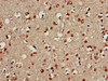 Immunohistochemistry of paraffin-embedded human brain tissue using CSB-PA890918LA01HU at dilution of 1:100