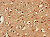 Immunohistochemistry of paraffin-embedded human brain tissue using CSB-PA891559LA01HU at dilution of 1:100
