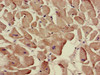 Immunohistochemistry of paraffin-embedded human heart tissue using CSB-PA893907LA01HU at dilution of 1:100