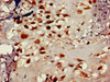 Immunohistochemistry of paraffin-embedded human placenta tissue using CSB-PA897283LA01HU at dilution of 1:100