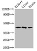 Western Blot<br />
 Positive WB detected in: Mouse kidney tissue, Rat liver tissue, Rat brain tissue<br />
 All lanes: KLF12 antibody at 2.5µg/ml<br />
 Secondary<br />
 Goat polyclonal to rabbit IgG at 1/50000 dilution<br />
 Predicted band size: 45, 29, 34 kDa<br />
 Observed band size: 45 kDa<br />