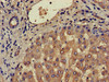 Immunohistochemistry of paraffin-embedded human liver tissue using CSB-PA004842LA01HU at dilution of 1:100