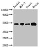 Western Blot<br />
 Positive WB detected in: Jurkat whole cell lysate, MCF-7 whole cell lysate, Mouse heart tissue, Mouse brain tissue<br />
 All lanes: ZNF645 antibody at 3.2µg/ml<br />
 Secondary<br />
 Goat polyclonal to rabbit IgG at 1/50000 dilution<br />
 Predicted band size: 49 kDa<br />
 Observed band size: 49 kDa<br />