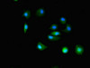 Immunofluorescent analysis of MCF-7 cells using CSB-PA724947LA01HU at dilution of 1:100 and Alexa Fluor 488-congugated AffiniPure Goat Anti-Rabbit IgG (H+L)