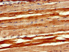Immunohistochemistry of paraffin-embedded human skeletal muscle tissue using CSB-PA770363LA01HU at dilution of 1:100
