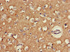 Immunohistochemistry of paraffin-embedded human brain tissue using CSB-PA819472LA01HU at dilution of 1:100