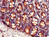 Immunohistochemistry of paraffin-embedded human small intestine tissue using CSB-PA849761LA01HU at dilution of 1:100
