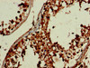 Immunohistochemistry of paraffin-embedded human testis tissue using CSB-PA851968LA01HU at dilution of 1:100