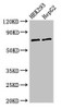 Western Blot<br />
 Positive WB detected in: HEK293 whole cell lysate, HepG2 whole cell lysate<br />
 All lanes: GTPBP4 antibody at 3µg/ml<br />
 Secondary<br />
 Goat polyclonal to rabbit IgG at 1/50000 dilution<br />
 Predicted band size: 74, 69, 61 kDa<br />
 Observed band size: 74 kDa<br />